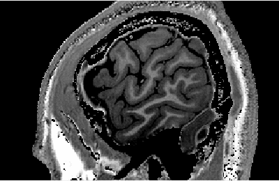 7T MRI 1