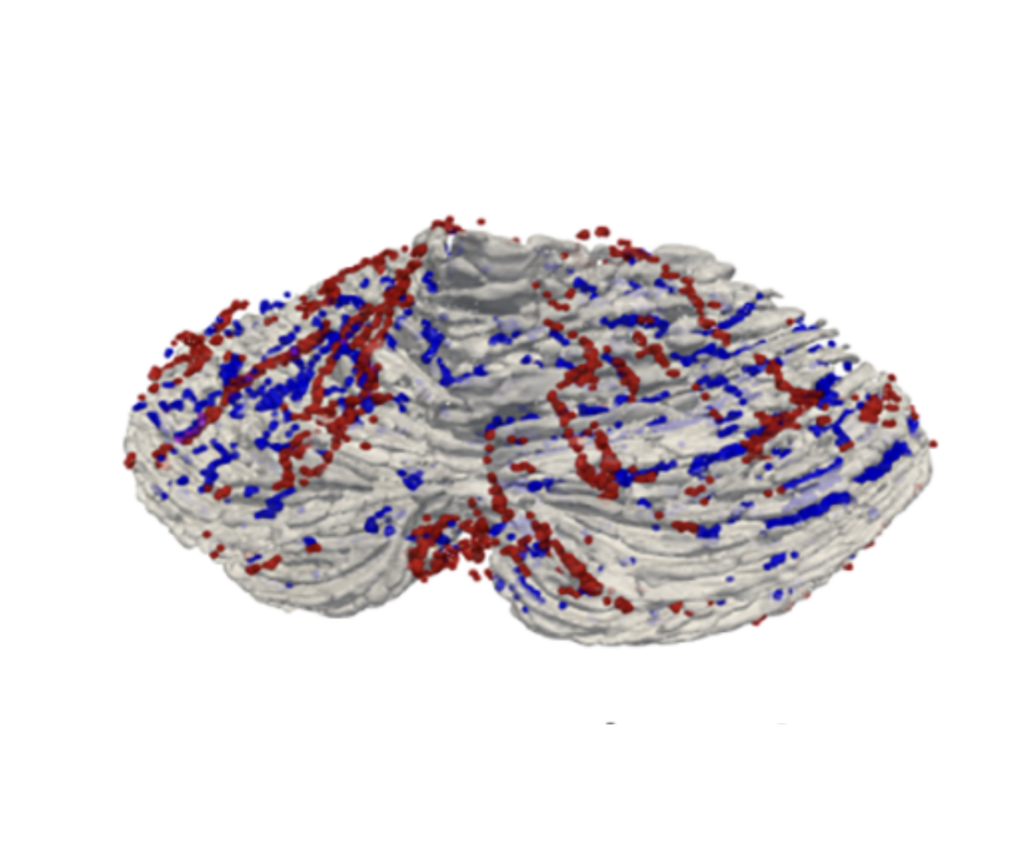 Detailed imaging of the cerebellum can yield major benefits for patients